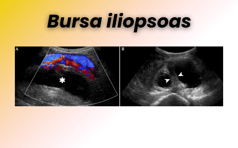 4. Patologia compartimento anterior cadera tempo formacion.png